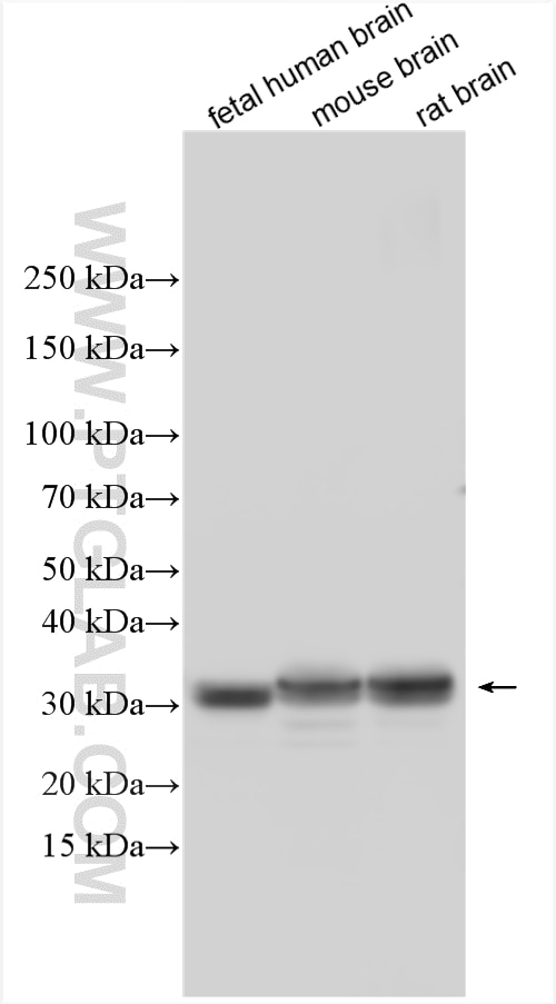 Western Blot (WB) analysis of various lysates using GPM6A Polyclonal antibody (15044-1-AP)