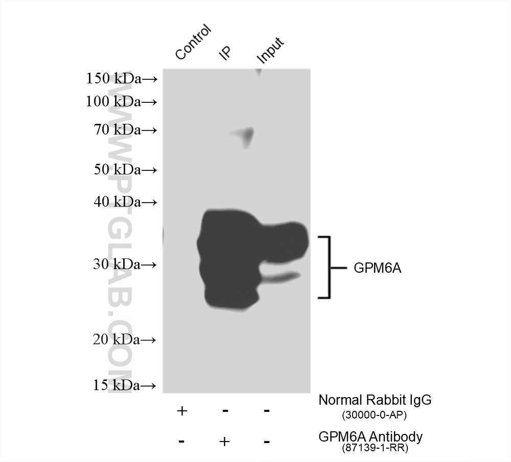 Immunoprecipitation (IP) experiment of mouse brain tissue using GPM6A Recombinant monoclonal antibody (87139-1-RR)