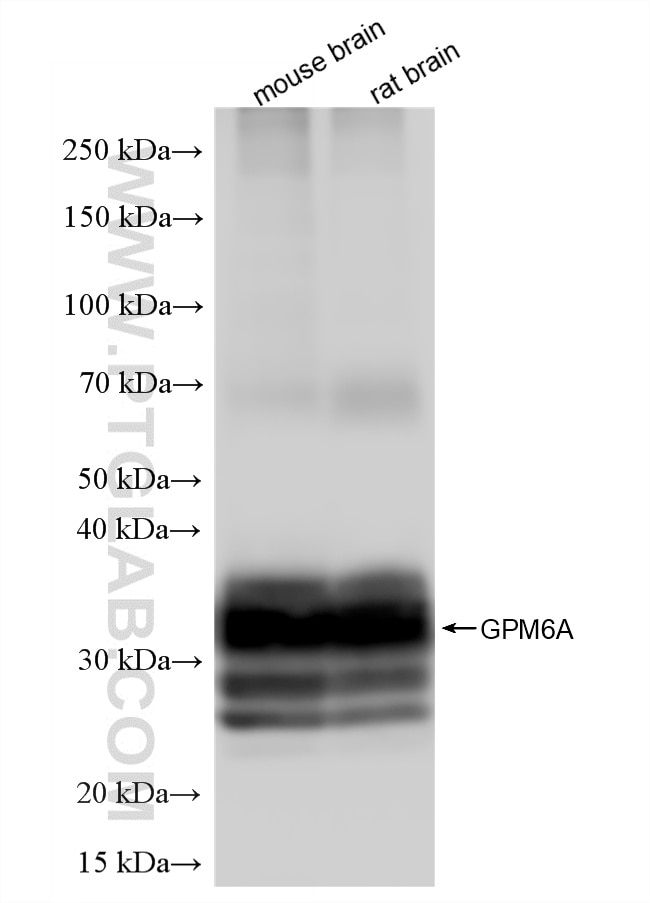 Western Blot (WB) analysis of various lysates using GPM6A Recombinant monoclonal antibody (87139-1-RR)