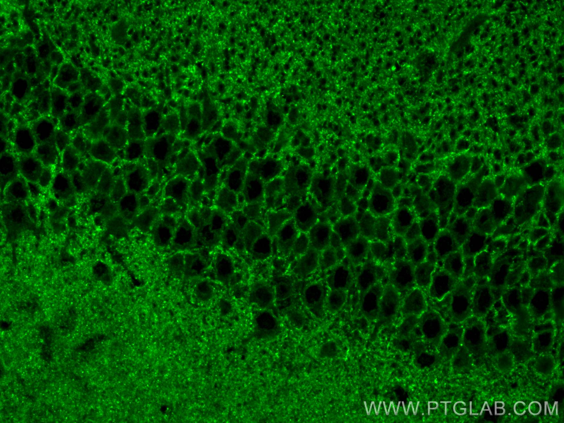 Immunofluorescence (IF) / fluorescent staining of mouse brain tissue using GPM6B Polyclonal antibody (26122-1-AP)
