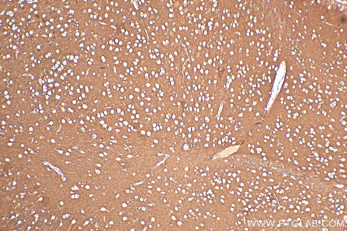 Immunohistochemistry (IHC) staining of mouse brain tissue using GPM6B Polyclonal antibody (26122-1-AP)
