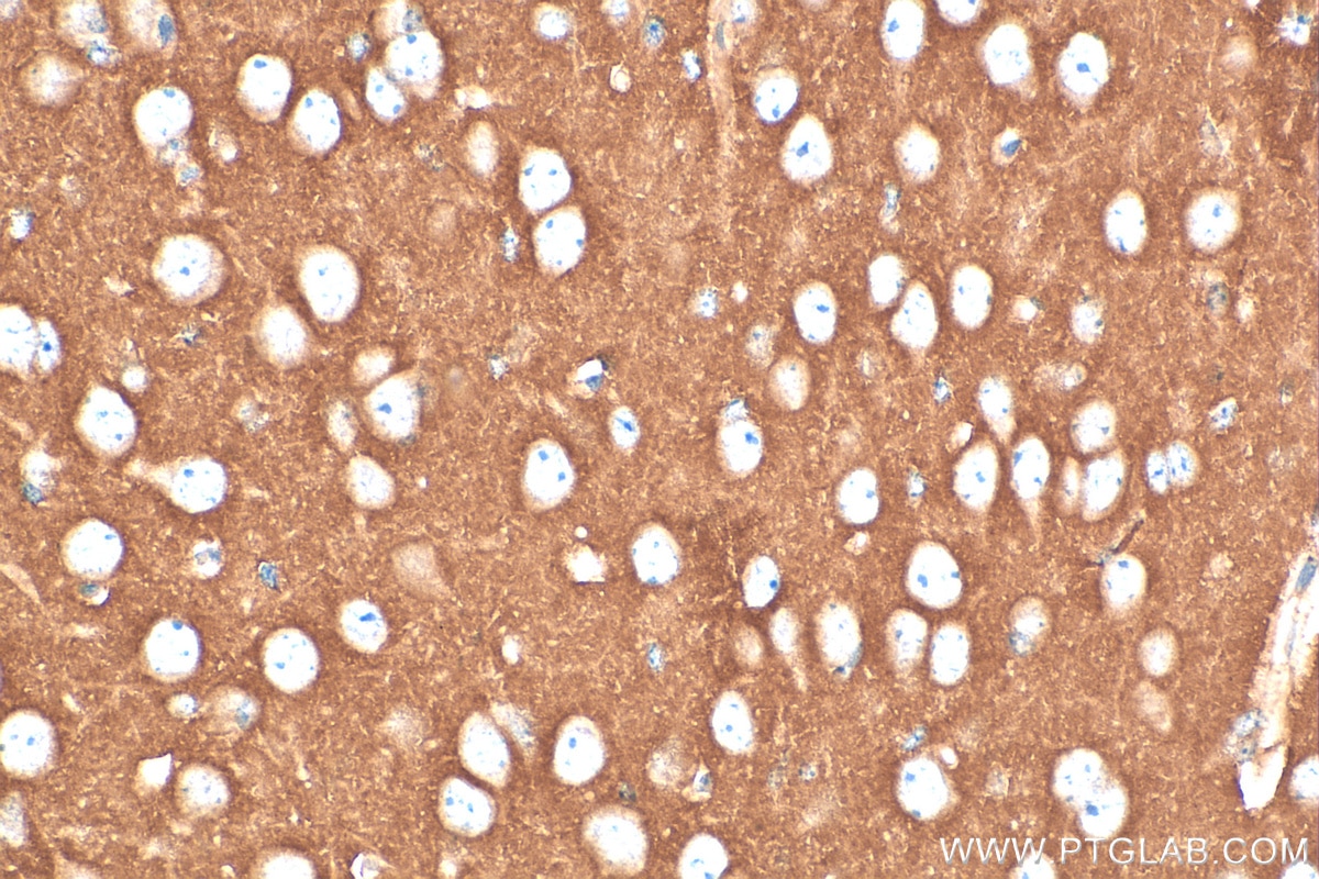 Immunohistochemistry (IHC) staining of mouse brain tissue using GPM6B Polyclonal antibody (26122-1-AP)
