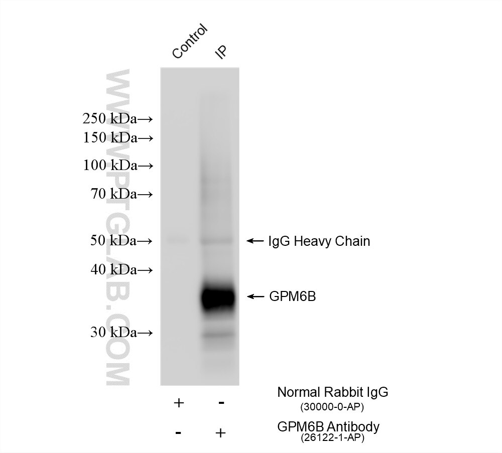 Immunoprecipitation (IP) experiment of rat brain tissue using GPM6B Polyclonal antibody (26122-1-AP)