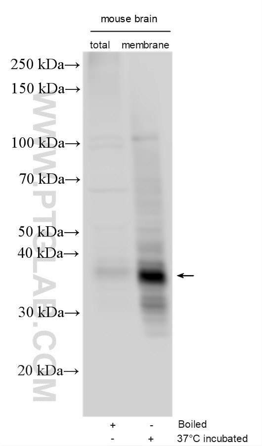 Western Blot (WB) analysis of various lysates using GPM6B Polyclonal antibody (26122-1-AP)