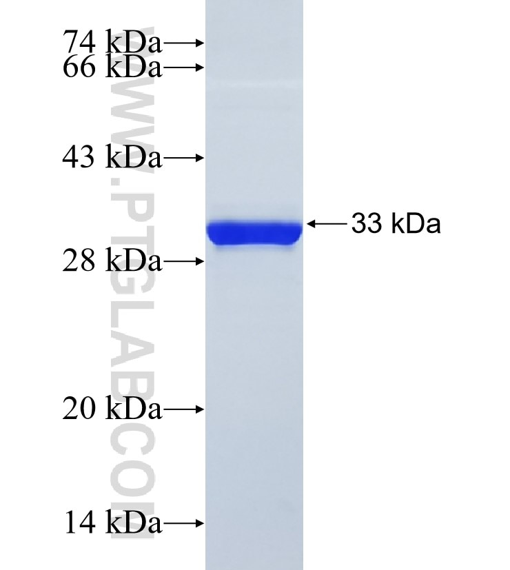 GPM6B fusion protein Ag23507 SDS-PAGE