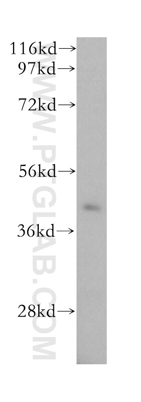 Western Blot (WB) analysis of human liver tissue using GPN1 Polyclonal antibody (15752-1-AP)