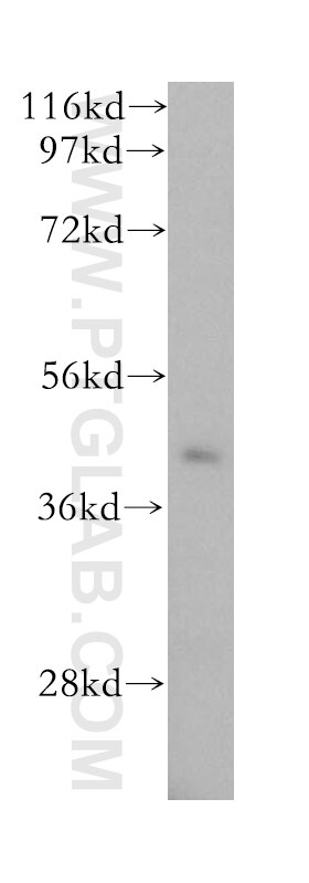 WB analysis of human liver using 15752-1-AP