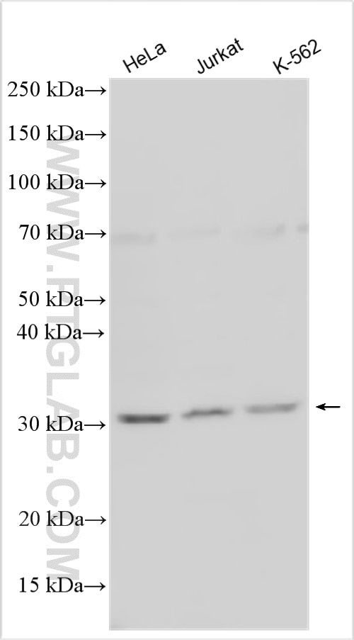 Various lysates were subjected to SDS PAGE followed by western blot with 33504-1-AP (GPN2 antibody) at dilution of 1:1500 incubated at room temperature for 1.5 hours. Western Blot (WB) analysis of various lysates using GPN2 Polyclonal antibody (33504-1-AP)