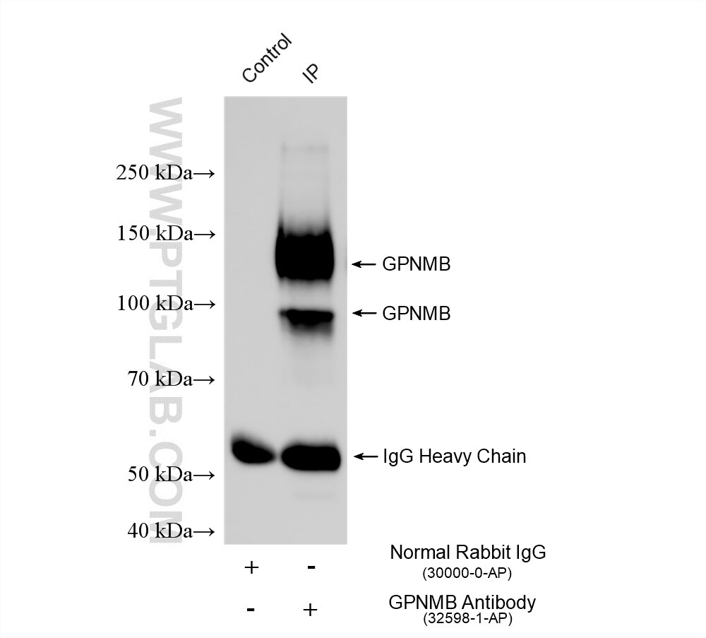 IP experiment of rat spleen using 32598-1-AP Immunoprecipitation (IP) experiment of rat spleen tissue using GPNMB Polyclonal antibody (32598-1-AP)