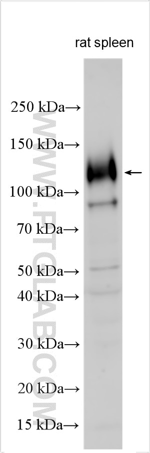Rat spleen tissue were subjected to SDS PAGE followed by western blot with 32598-1-AP (GPNMB antibody) at dilution of 1:400 incubated at room temperature for 1.5 hours. Western Blot (WB) analysis of various lysates using GPNMB Polyclonal antibody (32598-1-AP)