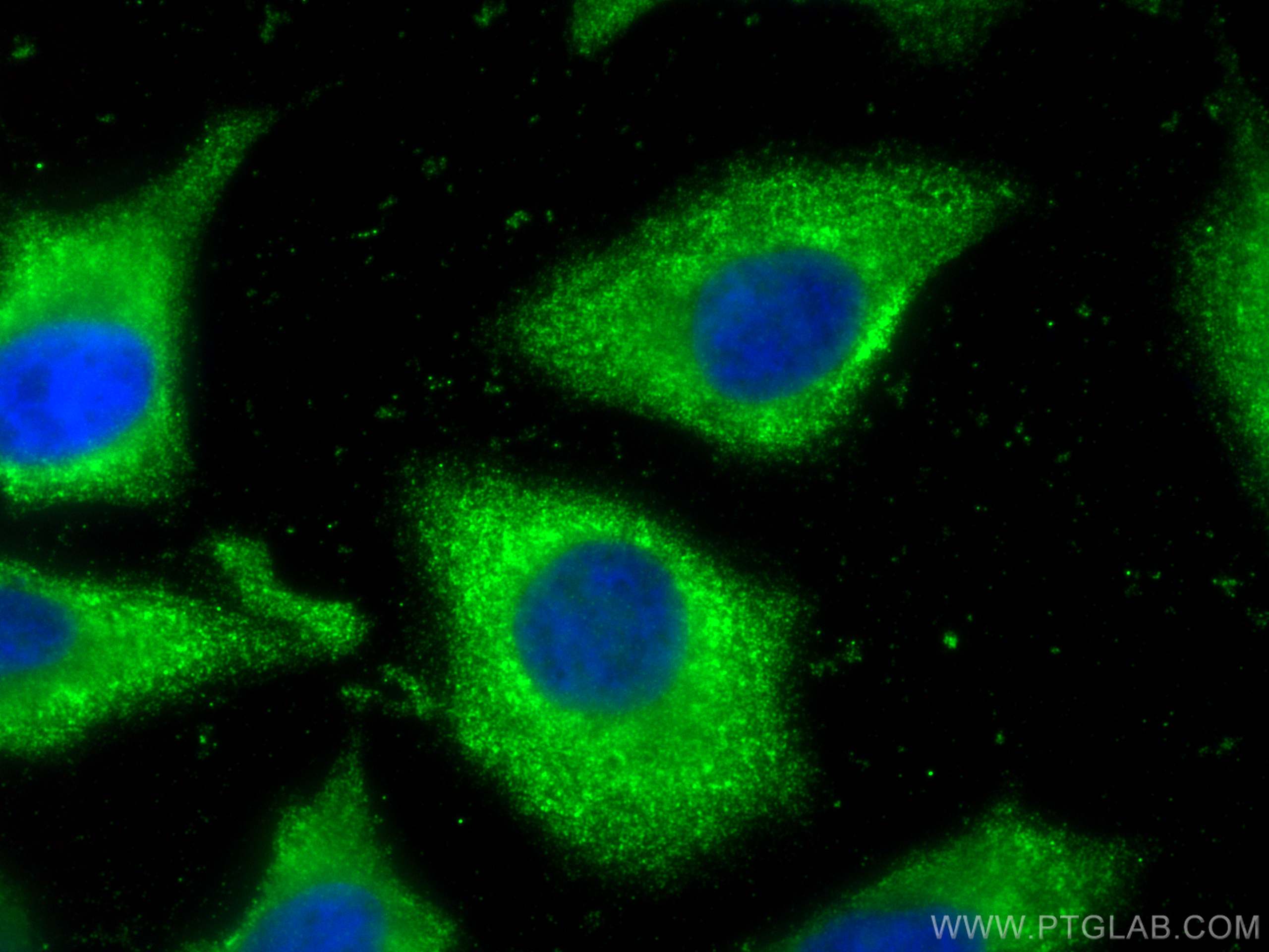 Immunofluorescence (IF) / fluorescent staining of HeLa cells using GPNMB Monoclonal antibody (66926-1-Ig)
