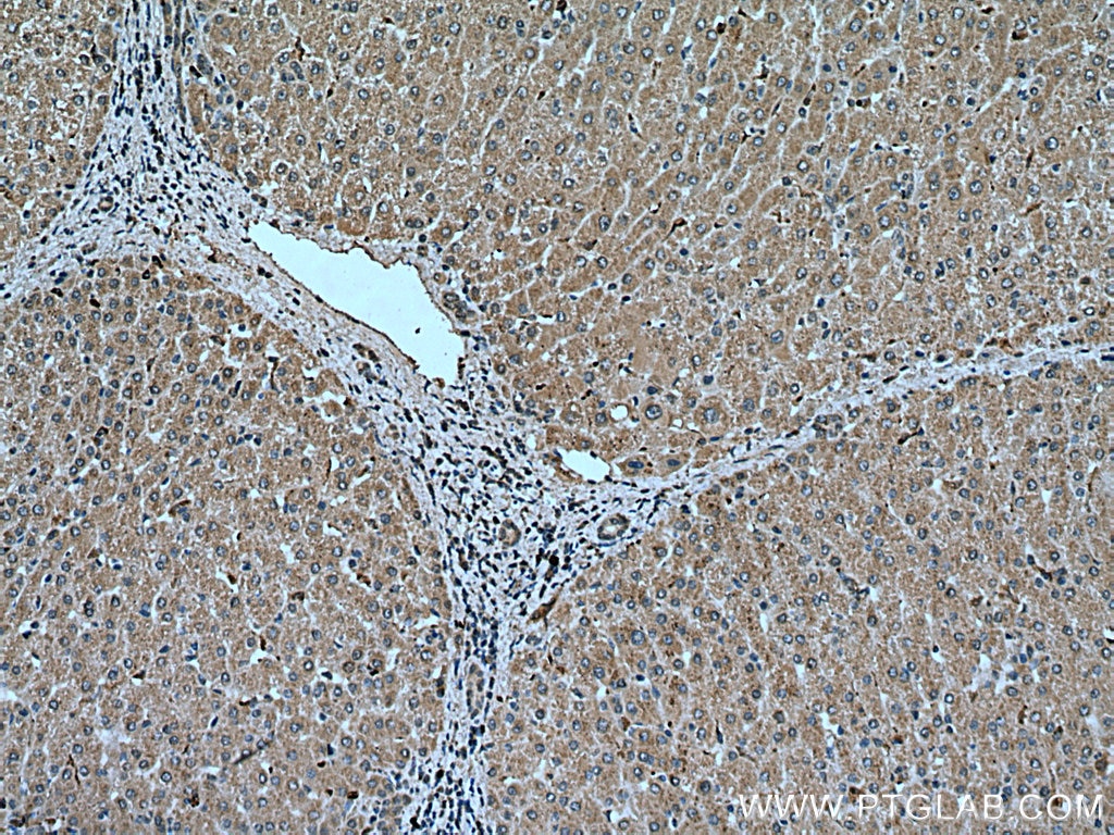 Immunohistochemistry (IHC) staining of human liver tissue using GPNMB Monoclonal antibody (66926-1-Ig)