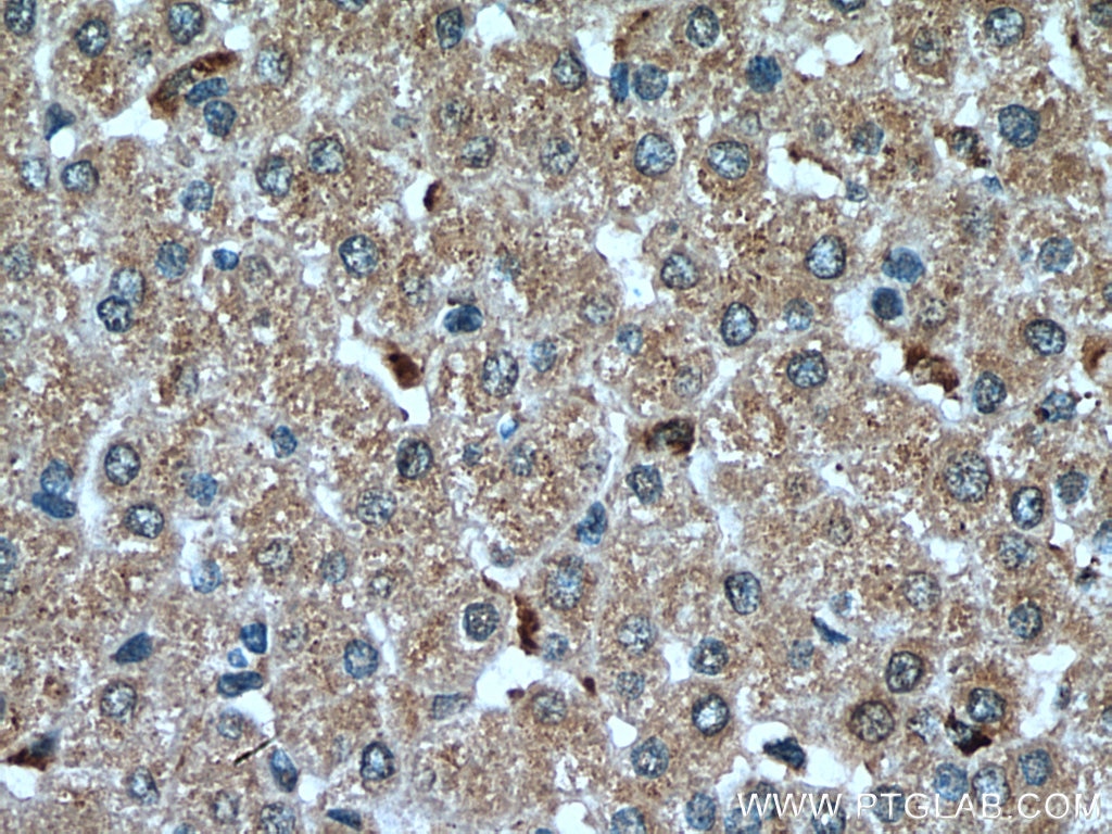 Immunohistochemistry (IHC) staining of human liver tissue using GPNMB Monoclonal antibody (66926-1-Ig)
