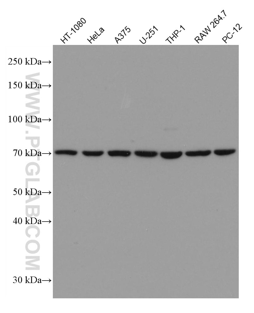 Western Blot (WB) analysis of various lysates using GPNMB Monoclonal antibody (66926-1-Ig)