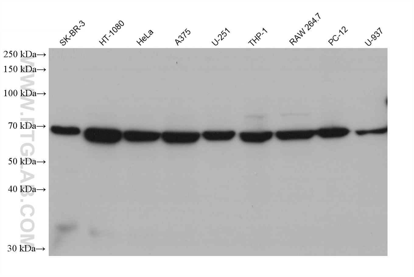 Western Blot (WB) analysis of various lysates using GPNMB Monoclonal antibody (66926-1-Ig)