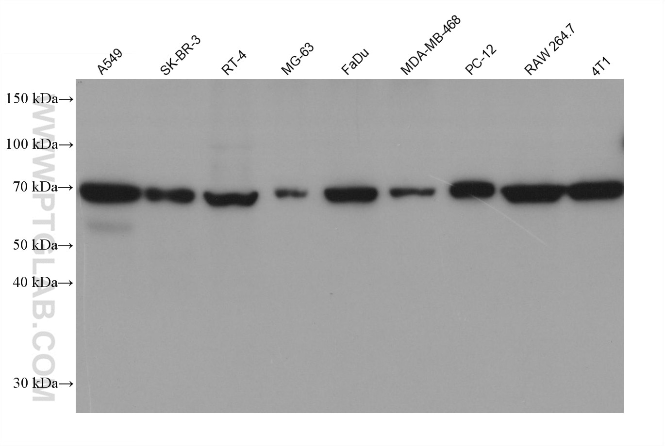 Western Blot (WB) analysis of various lysates using GPNMB Monoclonal antibody (66926-1-Ig)