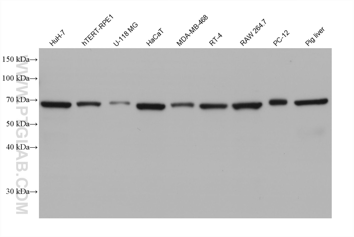 Western Blot (WB) analysis of various lysates using GPNMB Monoclonal antibody (66926-1-Ig)