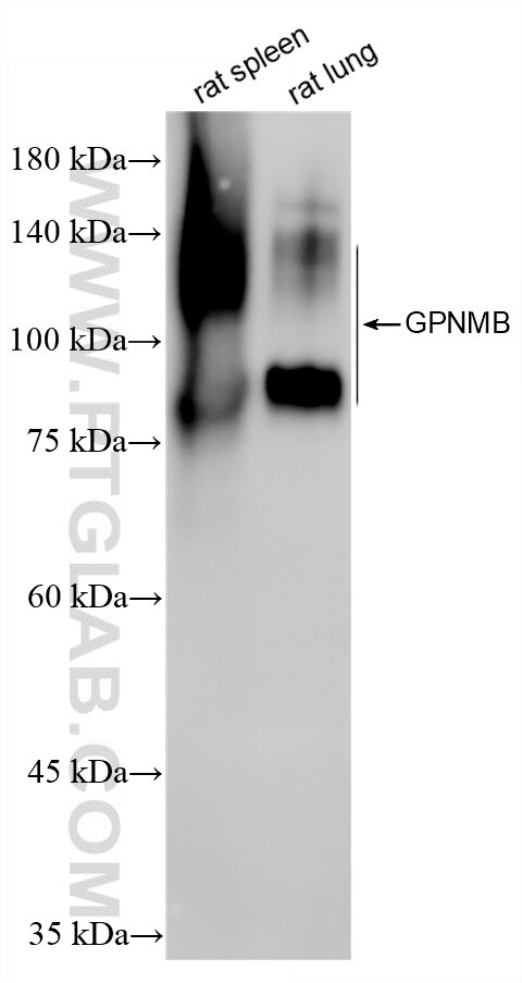 Various lysates were subjected to SDS PAGE followed by western blot with 85632-5-RR (Osteoactivin/GPNMB antibody) at dilution of 1:1000 incubated at room temperature for 1.5 hours. This data was developed using the same antibody clone with 85632-5-PBS in a different storage buffer formulation. Western Blot (WB) analysis of various lysates using GPNMB Recombinant monoclonal antibody (85632-5-RR)