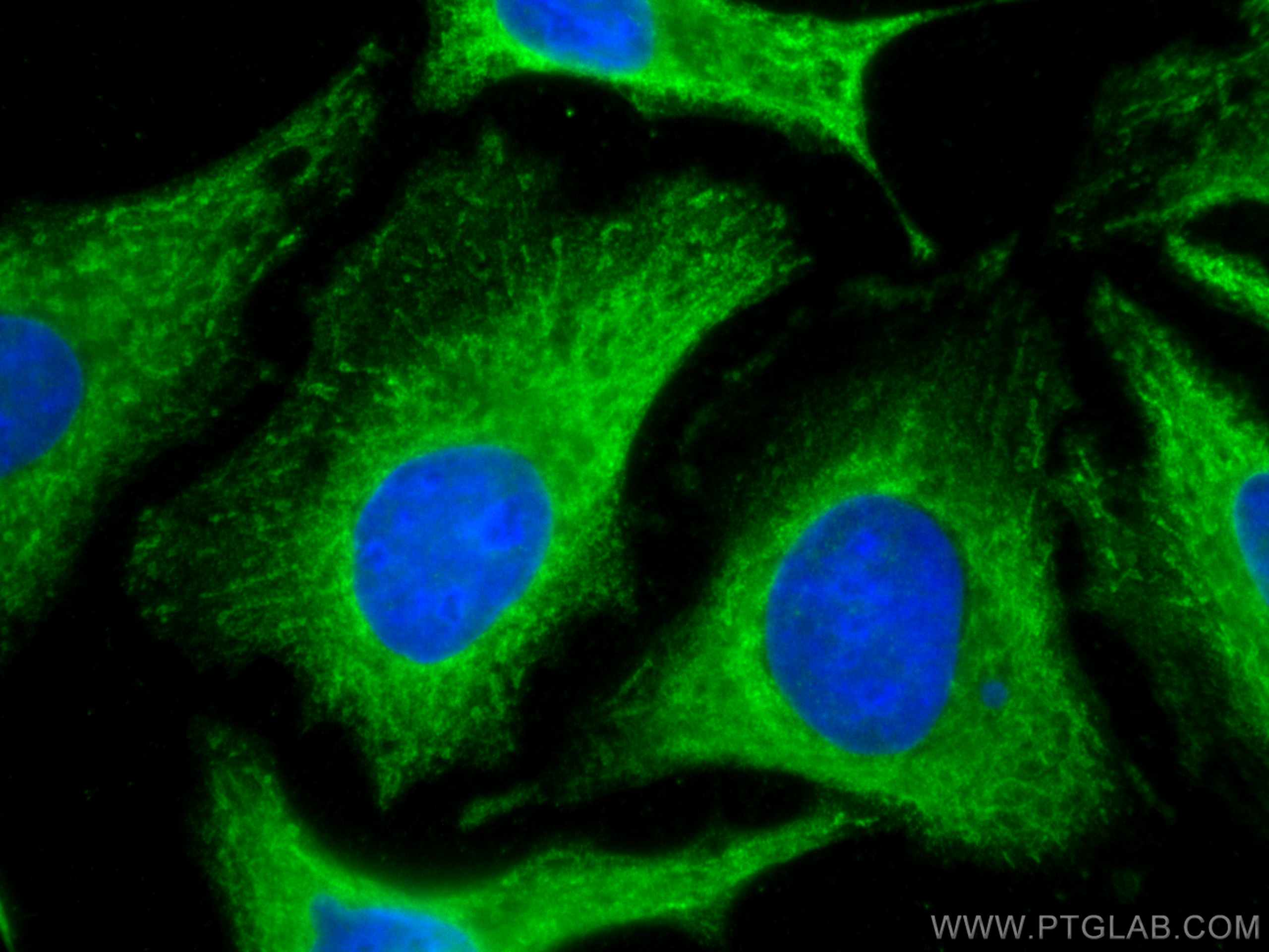 Immunofluorescence (IF) / fluorescent staining of HeLa cells using CoraLite® Plus 488-conjugated GPNMB Monoclonal ant (CL488-66926)