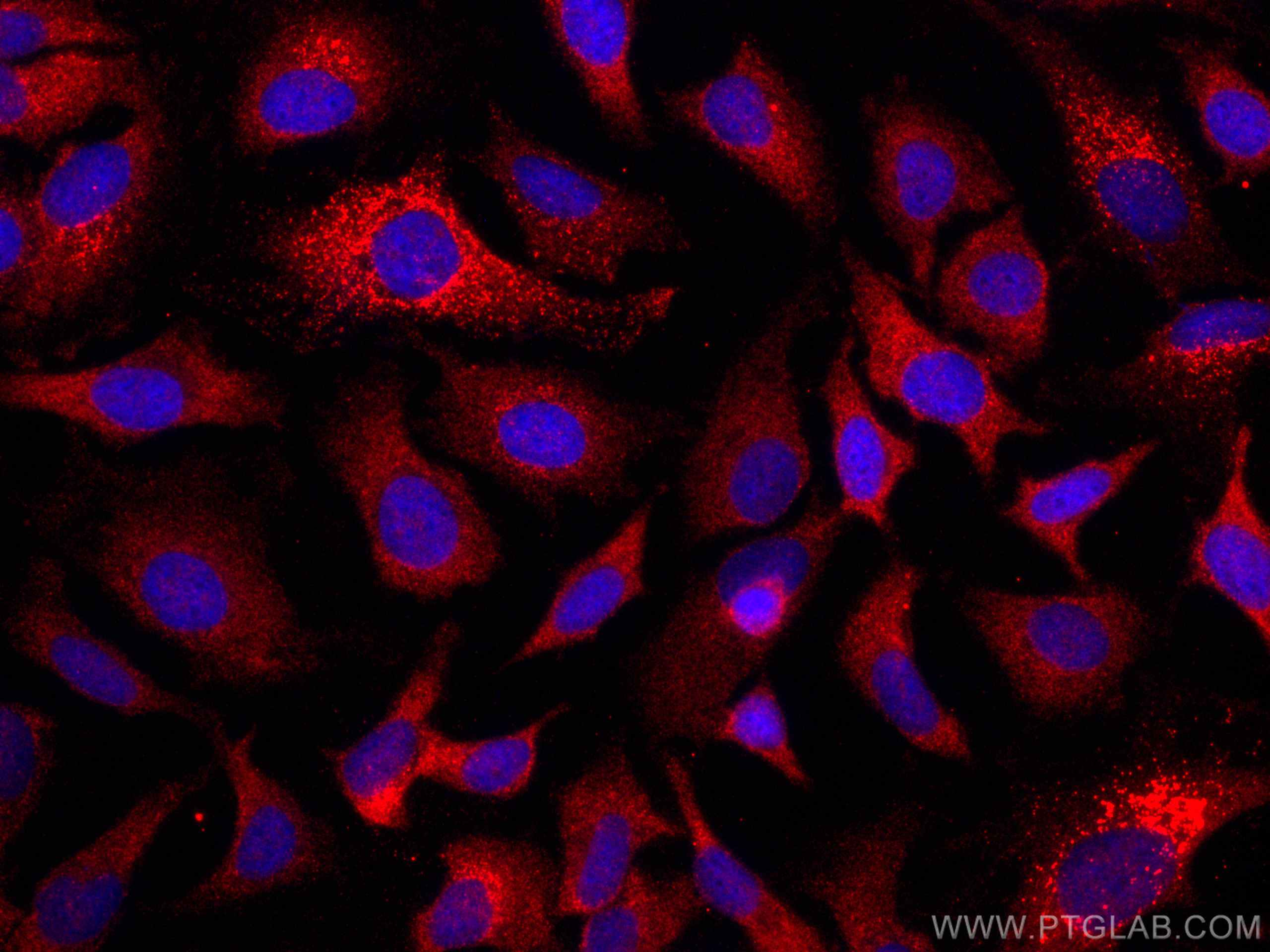Immunofluorescence (IF) / fluorescent staining of HeLa cells using CoraLite®594-conjugated GPNMB Monoclonal antibody (CL594-66926)
