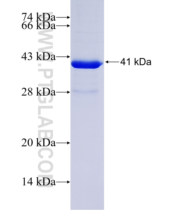 GPNMB fusion protein Ag25826 SDS-PAGE