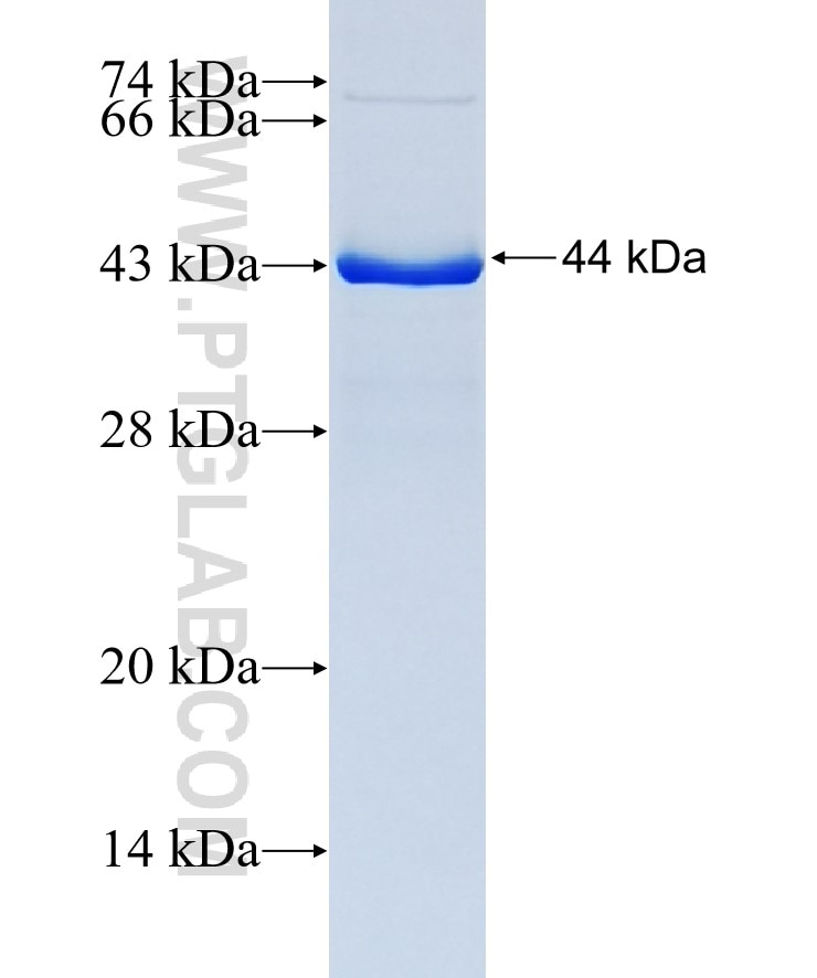 GPNMB fusion protein Ag14124 SDS-PAGE