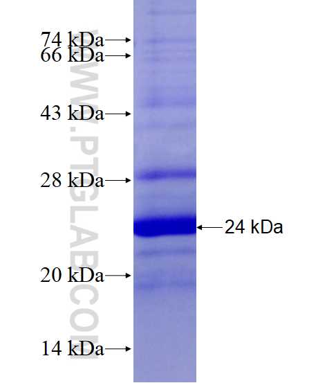 GPNMB fusion protein Ag14413 SDS-PAGE