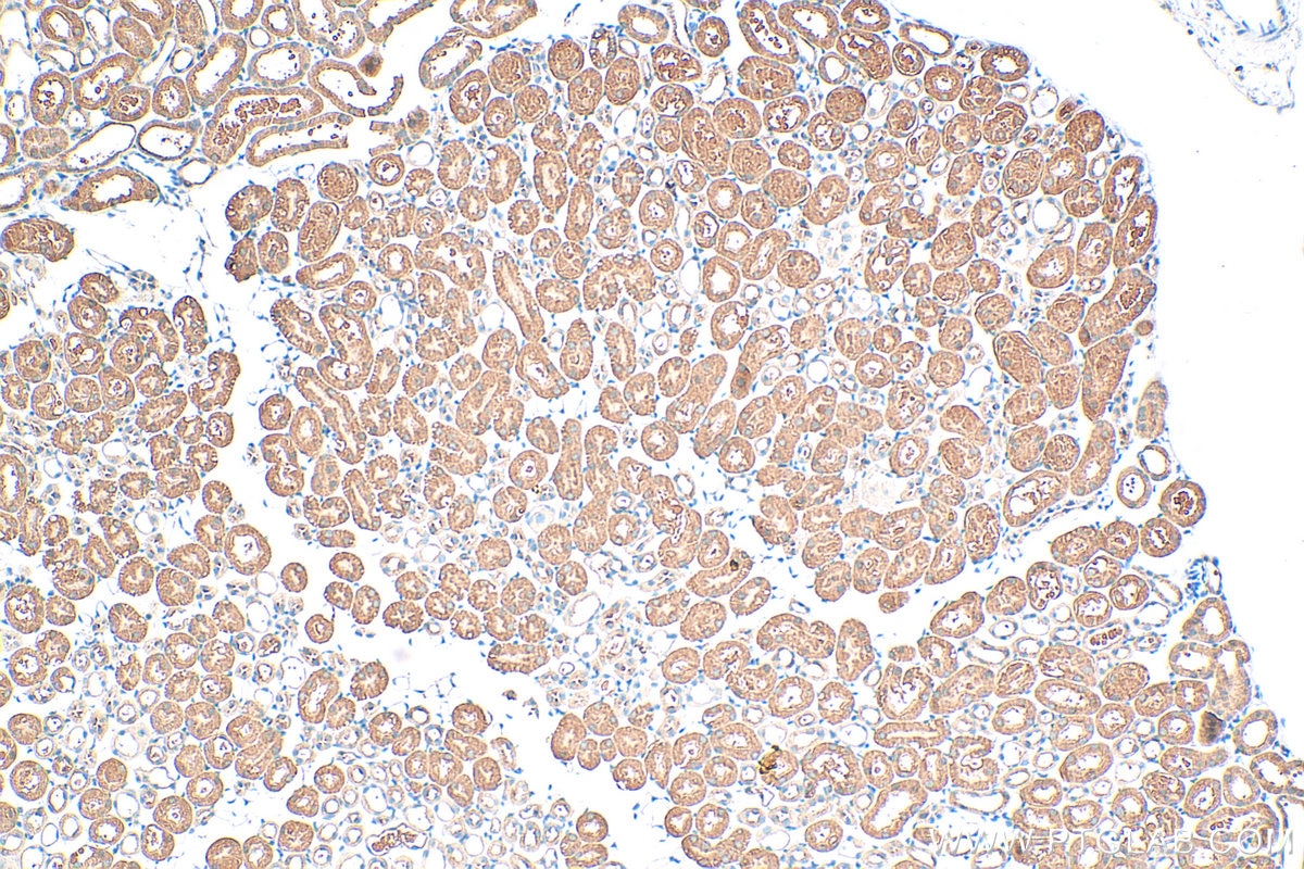Immunohistochemistry (IHC) staining of mouse kidney tissue using GPR101-Specific Polyclonal antibody (20074-1-AP)