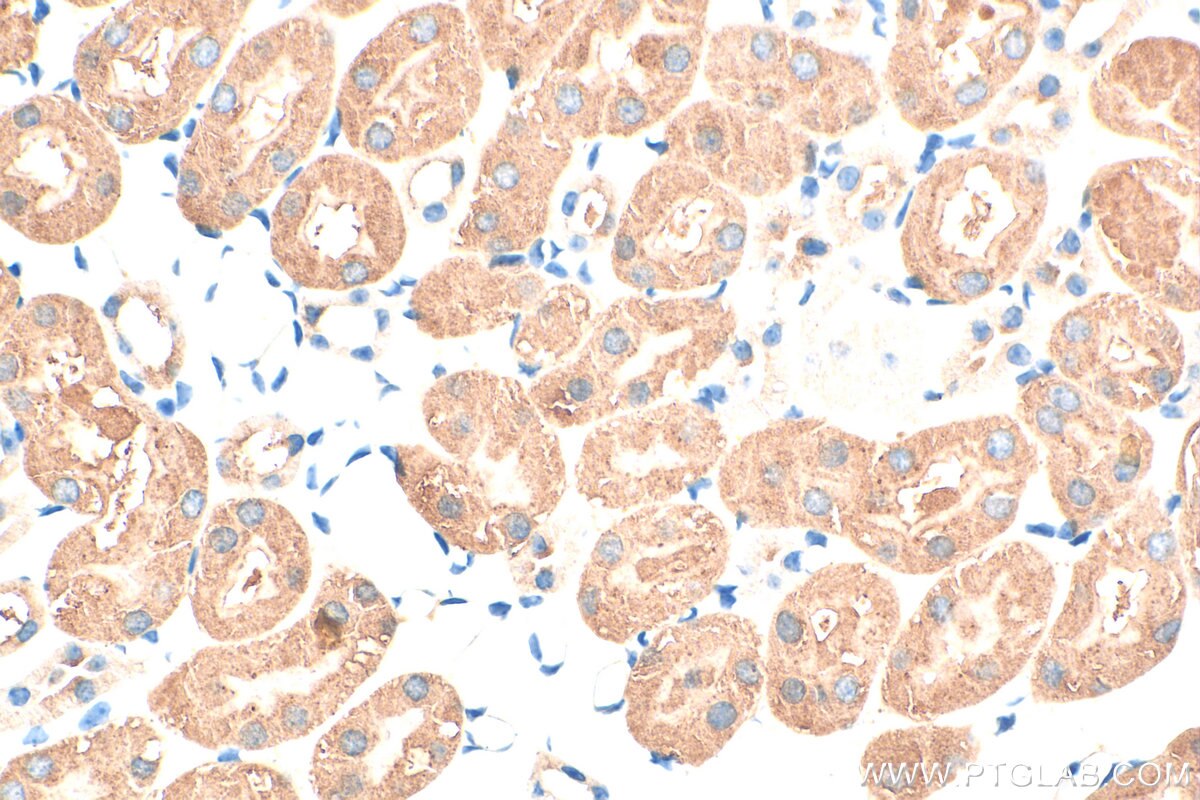 Immunohistochemistry (IHC) staining of mouse kidney tissue using GPR101-Specific Polyclonal antibody (20074-1-AP)