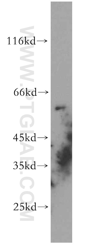 Western Blot (WB) analysis of HEK-293 cells using GPR101-Specific Polyclonal antibody (20074-1-AP)
