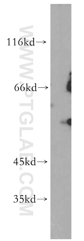 Western Blot (WB) analysis of COS-7 cells using GPR101-Specific Polyclonal antibody (20074-1-AP)