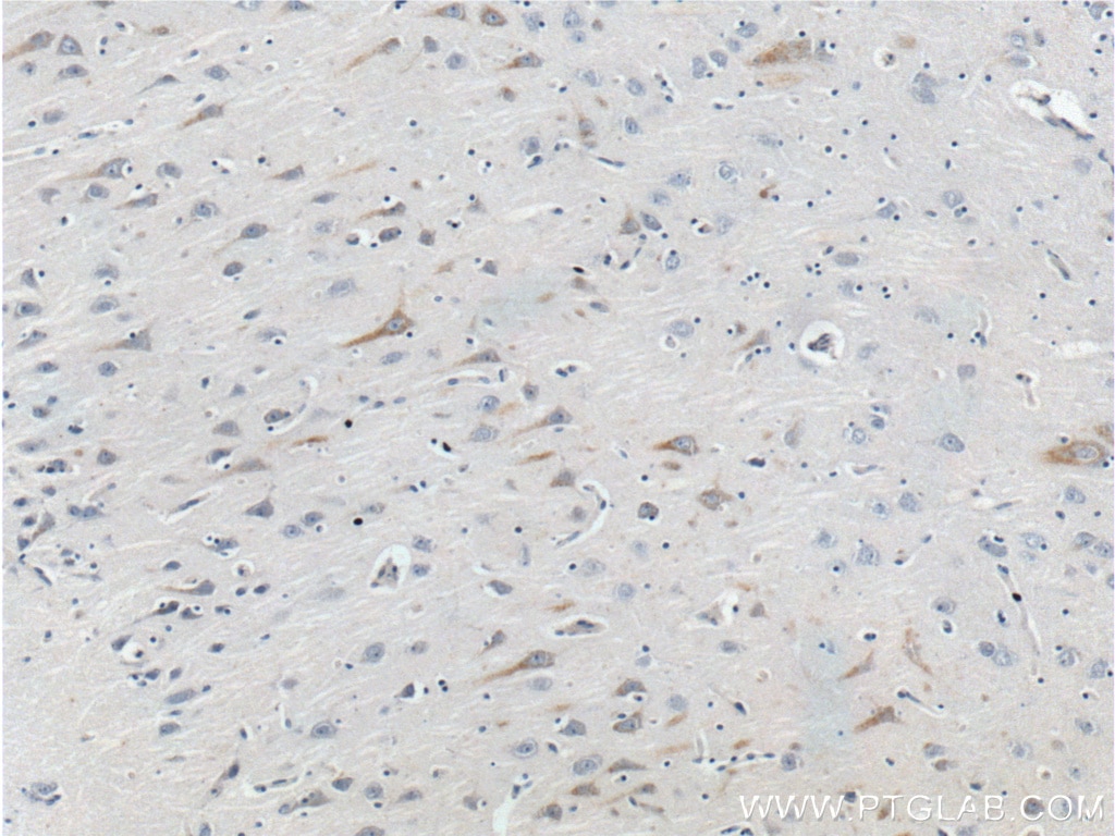 Immunohistochemistry (IHC) staining of human brain tissue using GPR103 Polyclonal antibody (25247-1-AP)