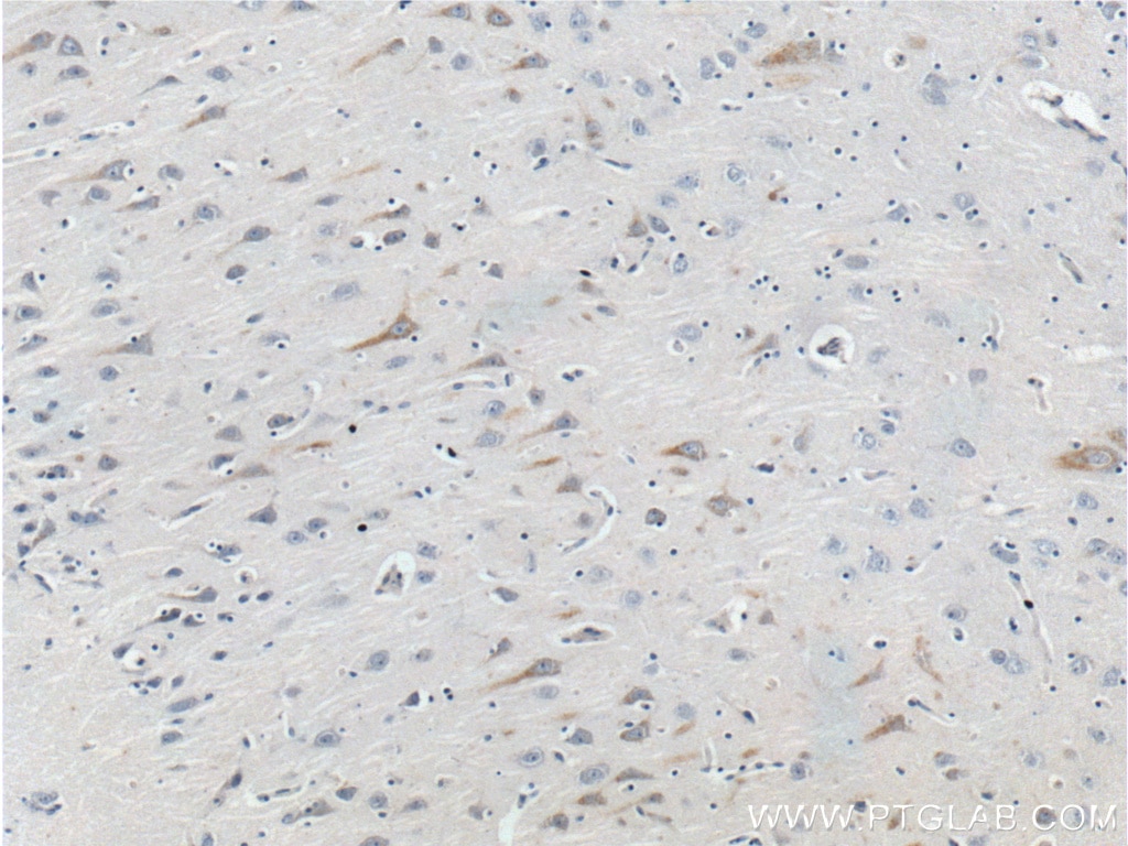 Immunohistochemistry (IHC) staining of human brain tissue using GPR103 Polyclonal antibody (25247-1-AP)