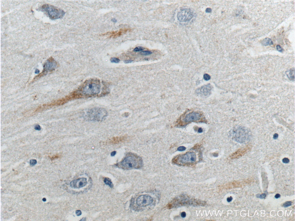 Immunohistochemistry (IHC) staining of human brain tissue using GPR103 Polyclonal antibody (25247-1-AP)
