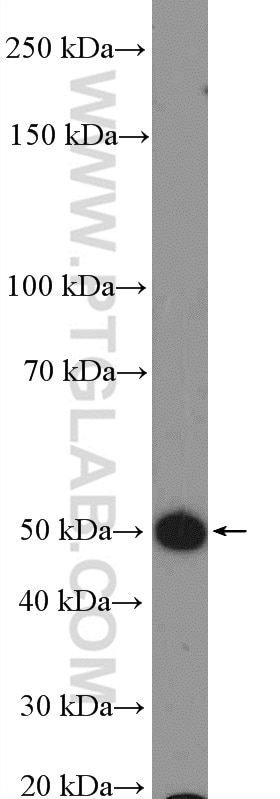 Western Blot (WB) analysis of mouse brain tissue using GPR103 Polyclonal antibody (25247-1-AP)