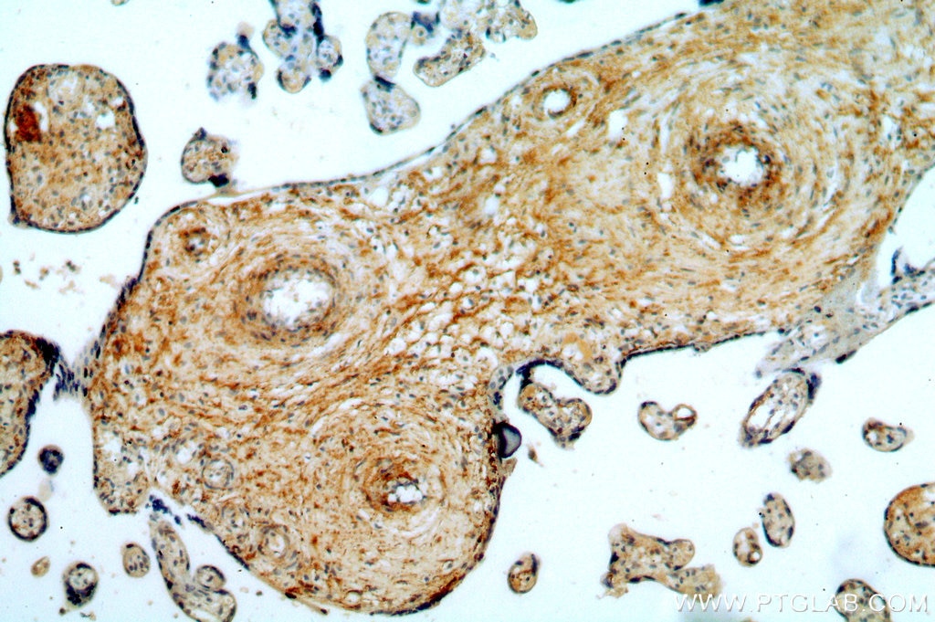 Immunohistochemistry (IHC) staining of human placenta tissue using GPR105 Polyclonal antibody (20190-1-AP)