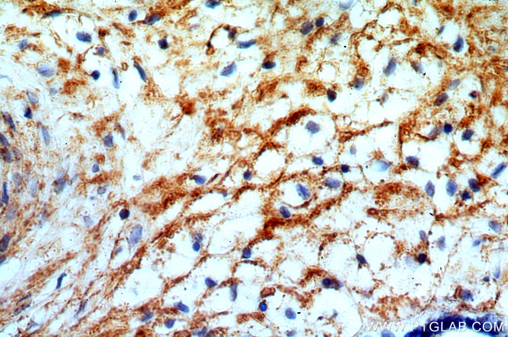 Immunohistochemistry (IHC) staining of human placenta tissue using GPR105 Polyclonal antibody (20190-1-AP)