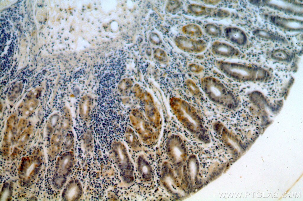 Immunohistochemistry (IHC) staining of human stomach tissue using GPR105 Polyclonal antibody (20190-1-AP)