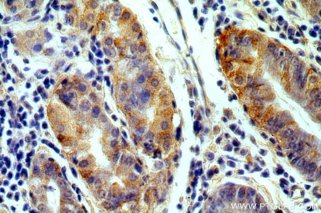 Immunohistochemistry (IHC) staining of human stomach tissue using GPR105 Polyclonal antibody (20190-1-AP)