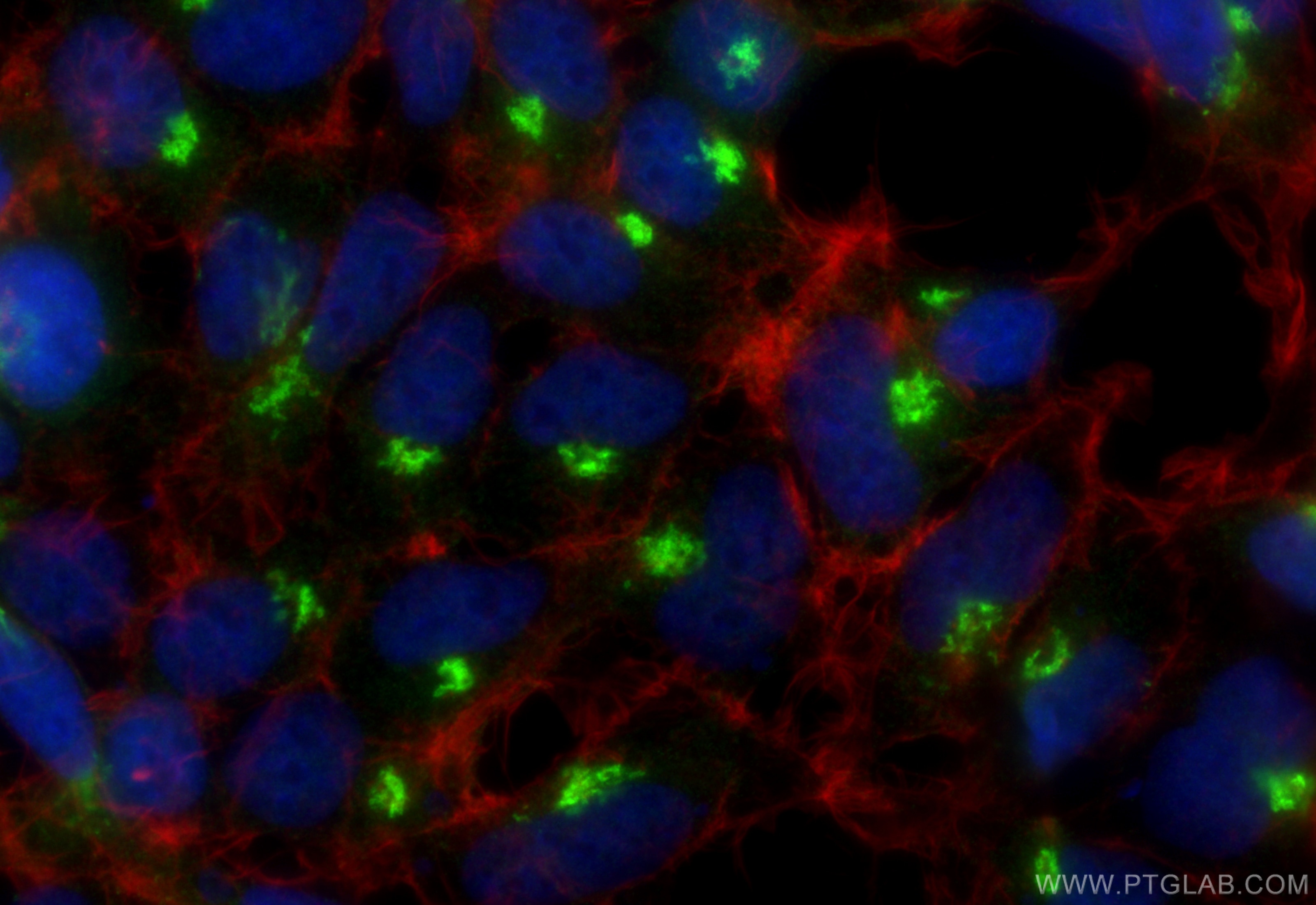 Immunofluorescence (IF) / fluorescent staining of HEK-293 cells using GPR107 Polyclonal antibody (25076-1-AP)