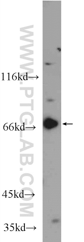 Western Blot (WB) analysis of HEK-293 cells using GPR107 Polyclonal antibody (25076-1-AP)