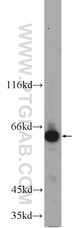 Western Blot (WB) analysis of mouse cerebellum tissue using GPR107 Polyclonal antibody (25076-1-AP)