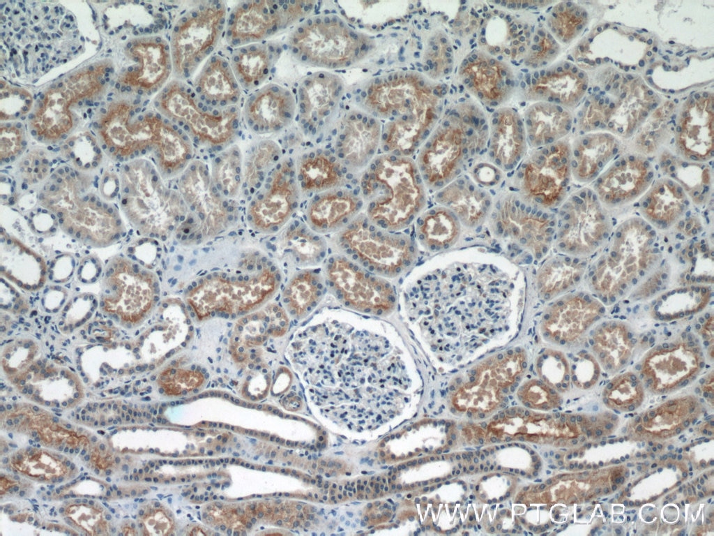 Immunohistochemistry (IHC) staining of human kidney tissue using GPR108 Polyclonal antibody (24009-1-AP)