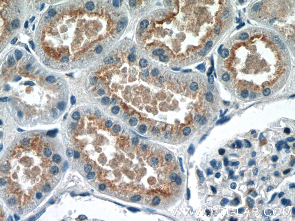 IHC staining of human kidney using 24009-1-AP