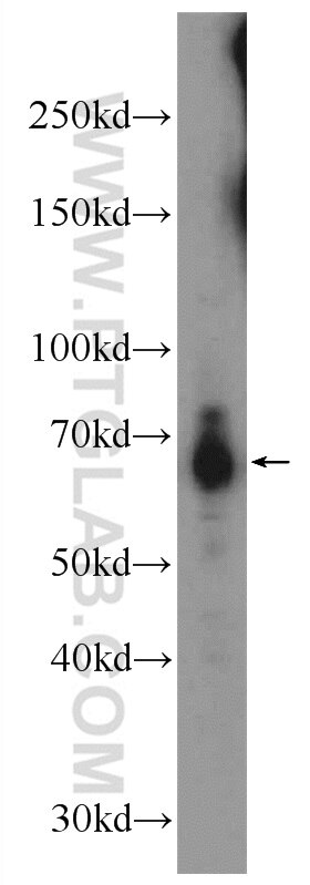 Western Blot (WB) analysis of mouse kidney tissue using GPR108 Polyclonal antibody (24009-1-AP)