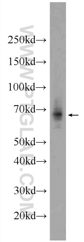 Western Blot (WB) analysis of rat kidney tissue using GPR108 Polyclonal antibody (24009-1-AP)