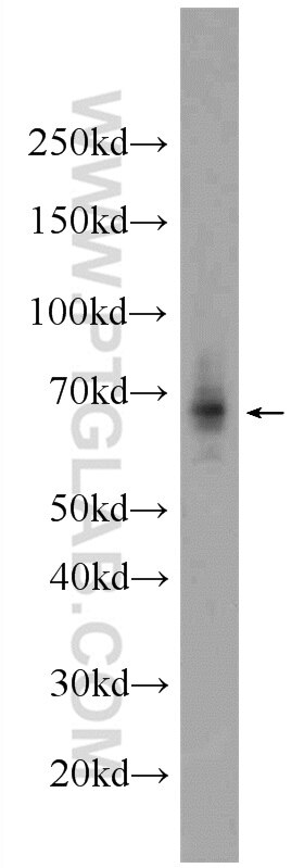 WB analysis of rat kidney using 24009-1-AP