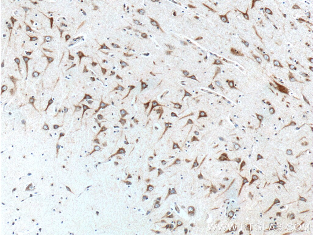 Immunohistochemistry (IHC) staining of human brain tissue using GPR111 Polyclonal antibody (24965-1-AP)