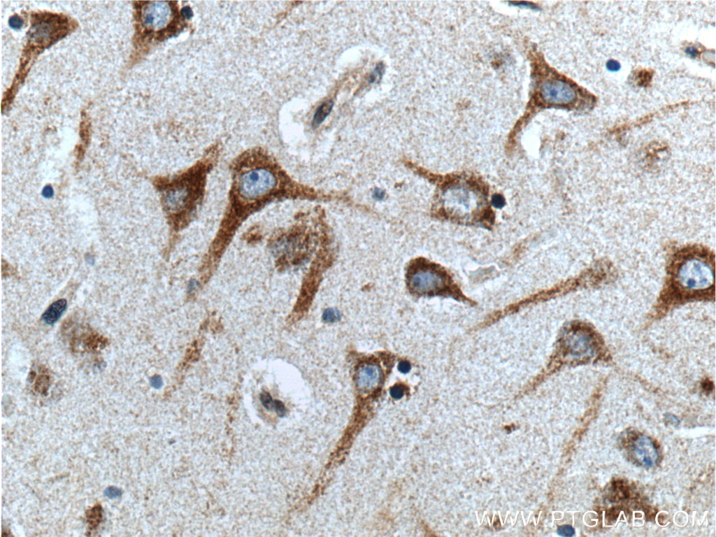 Immunohistochemistry (IHC) staining of human brain tissue using GPR111 Polyclonal antibody (24965-1-AP)