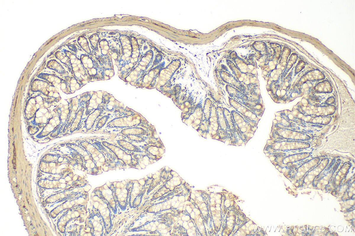 Immunohistochemistry (IHC) staining of mouse colon tissue using GPR112 Polyclonal antibody (31781-1-AP)